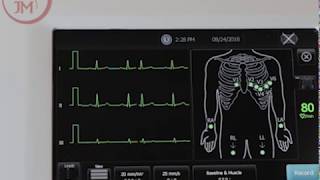 How to Use the Welch Allyn CP150 EKG Machine and Product Features [upl. by Tamanaha]