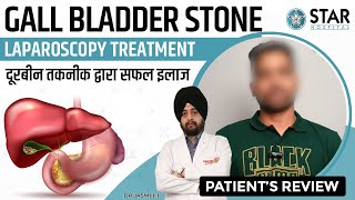 Best Hospital for Gall Bladder Stone in Punjab  Best Gall Bladder Doctor  Gall Bladder Treatment [upl. by Philips595]