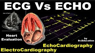 Rx Heart epi 16 e  ECG vs ECHO ENG  Electrocardiography vs Echocardiography  DrEducation [upl. by Esya]