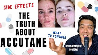 ACCUTANE  Dermatologist Review Unbiased [upl. by Ainslie]