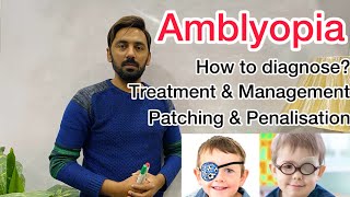 Amblyopia  Treatment amp management  patching amp penalisation [upl. by Ellissa]