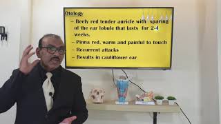 Relapsing polychondritis Malayalam Patient teaching programme [upl. by Cul]