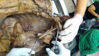 Fall 2012 Thoracic Vasculature Overview [upl. by Metzgar]