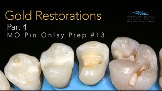 Cast Gold Restorations Part 4 MO Pin Onlay Preparation 13 [upl. by Venezia]