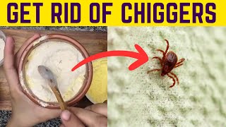 Effortlessly Remove Chiggers from Your Yard amp Prevent Their Bites [upl. by Meadow]