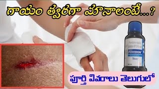 Povidone Iodine Solution Uses In Telugu  Antiseptic  Microbicidal Solution [upl. by Annavoig]