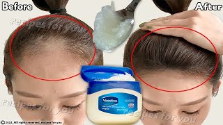 How to use Vaseline for double hair growth your hair will grow 3 times faster [upl. by Arrek256]