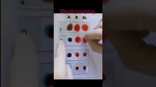 Blood grouping by slide method shorts abobloodgroup [upl. by Naes]