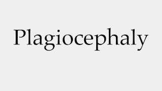 How to Pronounce Plagiocephaly [upl. by Ehttam]