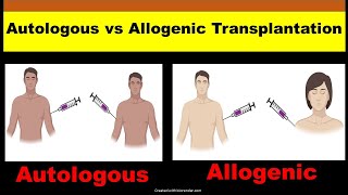 Autologous vs Allogeneic Transplant  Autologous and Allogeneic Stem Cell Transplantation [upl. by Ile547]