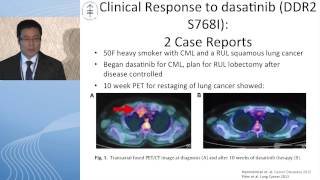 Squamous cell carcinoma Is there hope for targeted therapy [upl. by Yerffeg533]