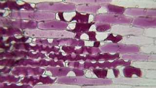 Plasmolysis of Red Onion in Sucrose [upl. by Jorrie]