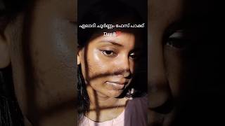 ✅ Acne Scars മാറ്റണോ facepackforacne facepackforoilyskin facemaskforacne [upl. by Ahtel]