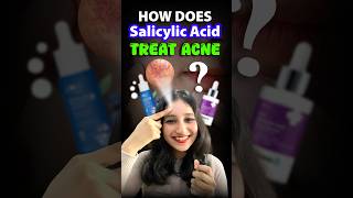 How does Salicylic acid treat acne acne salicylicacid serum csirnet neet biology sciencefact [upl. by Aleece916]