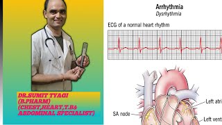 DISORDERS OF RATE amp RHYTHM BY DRSUMIT TYAGISUMITMEDICALDISPENSARY1 [upl. by Sinnel]