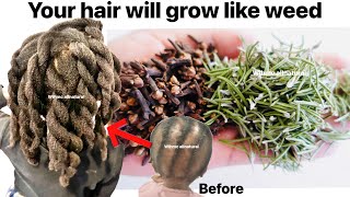 Clove amp Rosemary spray for X10 hair growth The only STRONGEST potent recipe EVER [upl. by Nonez]