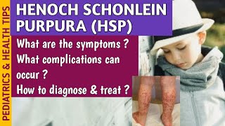 Henoch Schonlein Purpura HSP Causes Symptoms Diagnosis amp Treatment In Pediatrics [upl. by Namyac]