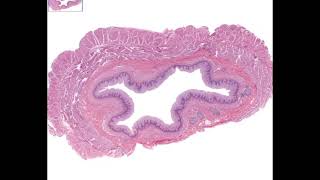 Histology esophagus [upl. by Nimsay]