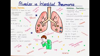 Alveolar vs Interstitial Pneumonia comparison [upl. by Ynnaf]