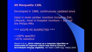 Managing STEMI Mimics in the Prehospital Environment part 13 [upl. by Etnuaed104]