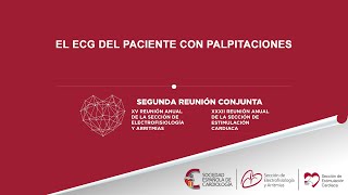 El ECG del paciente con palpitaciones [upl. by Einaej]