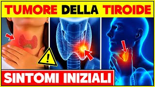 5 Segni e Sintomi Iniziali Del Tumore Alla Tiroide  Tumore Tiroideo Sintomi Precoci [upl. by Eeslek]