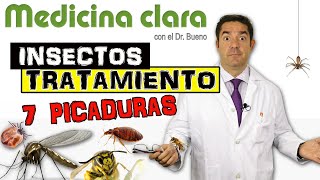 7 PICADURAS de INSECTOS TRATAMIENTO  Especial ATENCIÓN a las 2 ÚLTIMAS  Medicina Clara [upl. by Maddi]