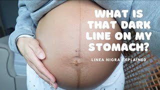 What is that dark line on my stomach in pregnancy The Linea Nigra [upl. by Bordie]