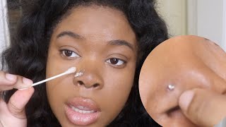 To Get Rid Of A Nose Piercing Bump FAST KELOID [upl. by Kristof]