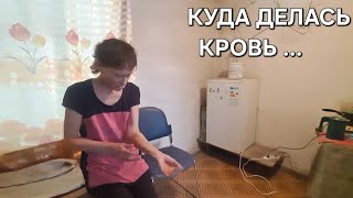 КРОВЬ БРАЛИ С НОГИ  КОГДА БУДЕТ ОПЕРАЦИЯ У ЛЮДМИЛЫ  ВОЛОДЯ УМИРАЕТ 🤔 [upl. by Fesuoy]