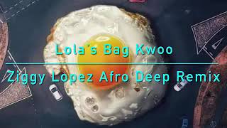 TRLER Lolas Bag Kwoo Ziggy Lopez Afro Deep Remix [upl. by Canute]