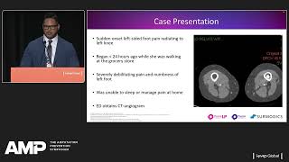 Dr Joseph Blas Proximal Tibial Artery Occlusion Treated with the Pounce™ Thrombectomy System [upl. by Walston150]