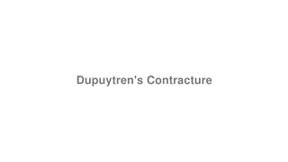 How to Pronounce quotDupuytrens Contracturequot [upl. by Ateekram985]