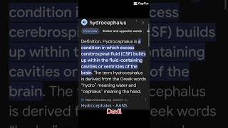 hydrocephalus [upl. by Sparks]