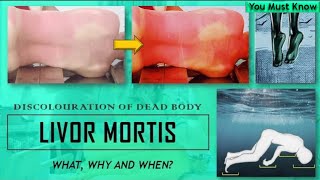 Livor Mortis  Discolouration of the Dead Body  Early Changes  Thanatology  You Must Know [upl. by Ordnassela]