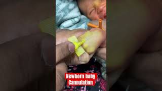 New born baby cannulation ivcannulation mbbs ivinsertion SMpharmacy subscribe [upl. by Mckinney]