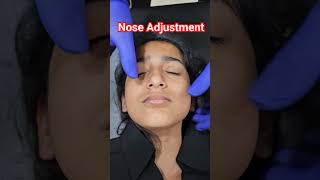 Chiropractic for nose adjustment [upl. by Atteuqcaj]