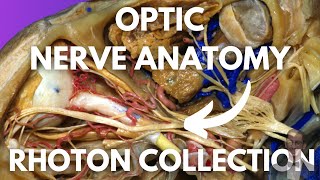 Optic Nerve Neuroanatomy Simplified Rhoton Collection [upl. by Brok]