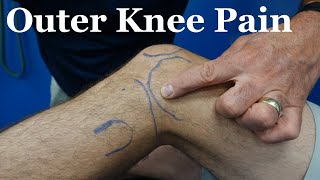 Most Common Causes of Lateral Knee Pain [upl. by Cart624]