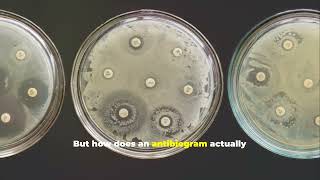 Antibiogram Unlocking the Secrets of Antibiotics [upl. by Namwob]