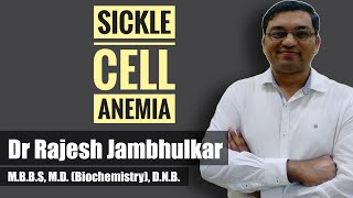 Sickle cell anemia [upl. by Aikemal]