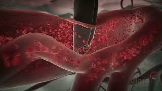 Malaria 3D Animation Shows How the Infection Spreads in the Body [upl. by Ganny]