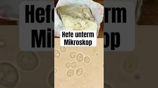 So sieht Hefe unterm Mikroskop aus wissenswert biologie natur mikrokosmos mikroskop fyp [upl. by Burney631]