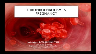 Thromboembolism in Pregnancy [upl. by Rox]