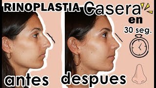 RINOPLASTIA CASERA SIN cirugia NI maquillaje en tan SOLO 30 SEGUNDOS [upl. by Sivi]