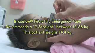 Pediatric Laryngoscope Blade Length Selection [upl. by Massimo]