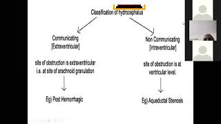 Neurology Hydrocephalus part 1 [upl. by Eilrahc819]