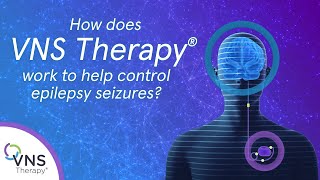 How does VNS Therapy Epilepsy Treatment Work [upl. by Joacimah229]