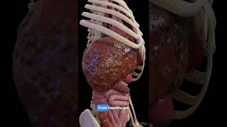 Understanding Liver Cirrhosis Key Facts anatomy meded 3dmodel [upl. by Lleirbag952]