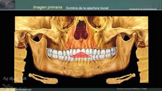 Estructuras anatómicas en la radiografía panorámica II [upl. by Ellerred]